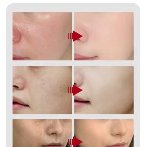 vitamin c face serum